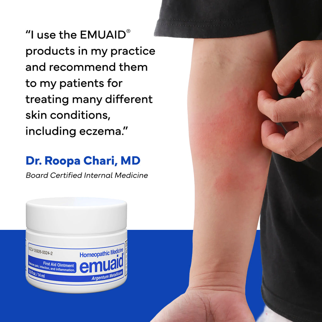 Person with redness on their arm next to an EMUAID product jar, with a quote from Dr. Roopa Chari, MD. Person with redness on their arm next to an EMUAID product jar, with a quote from Dr. Roopa Chari, MD.