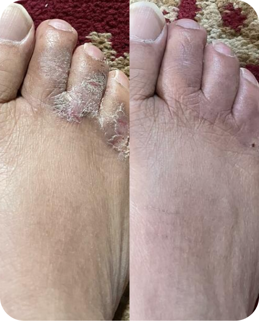 Clinical study results