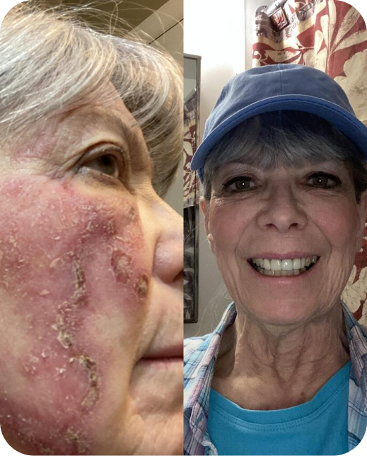 Clinical study results