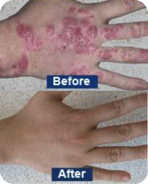 Clinical study results