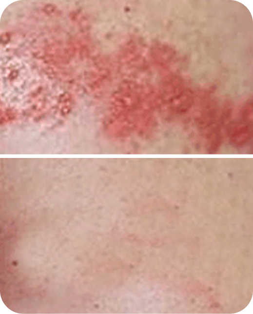 Clinical study results