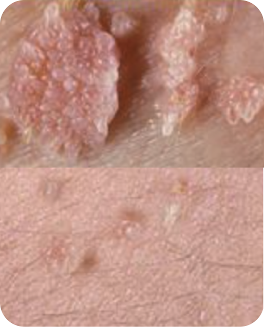 Clinical study results