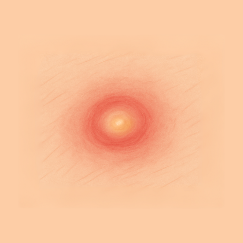 Drawn image of a boil