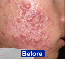 Clinical study results