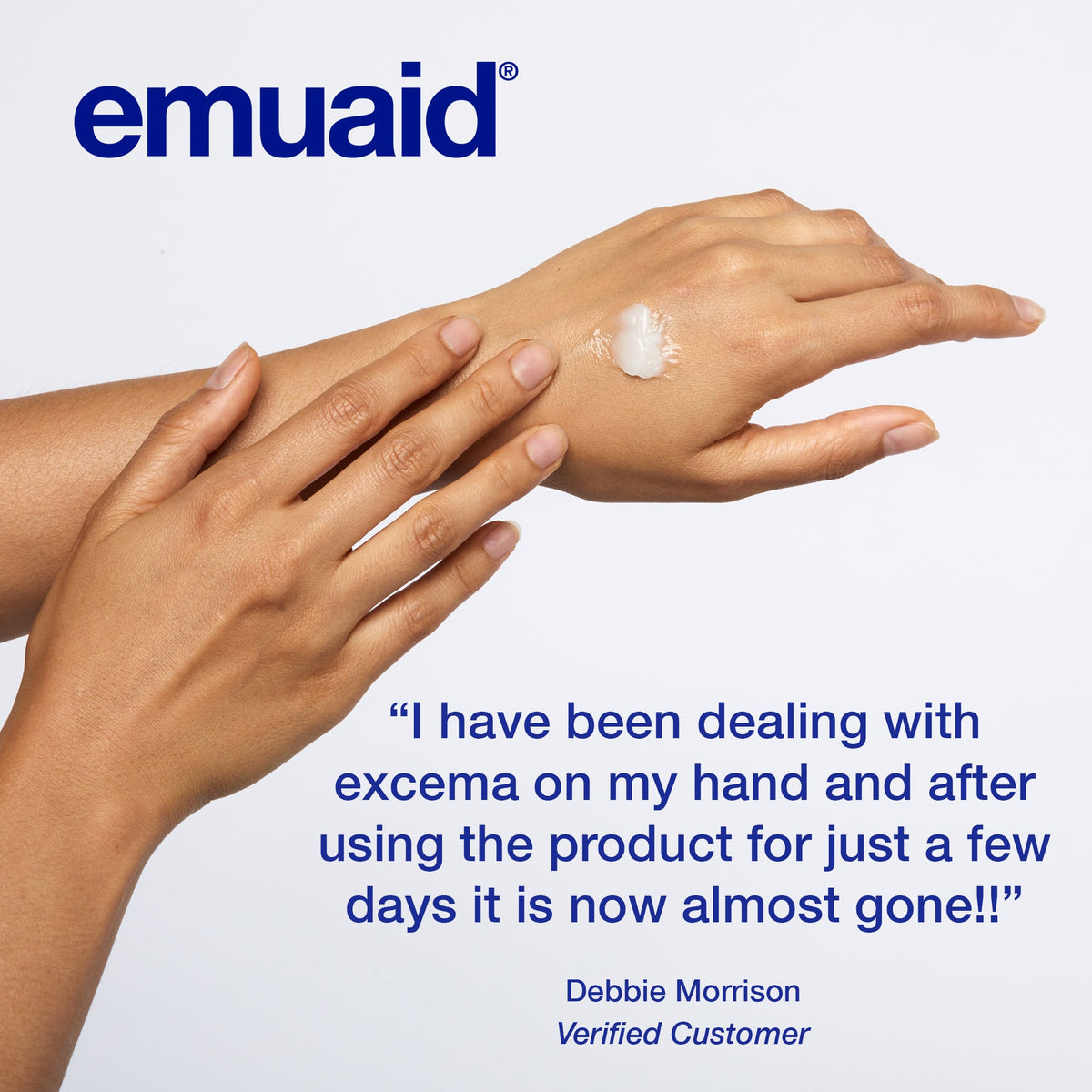 emuaid ointment applied to hand for eczema relief