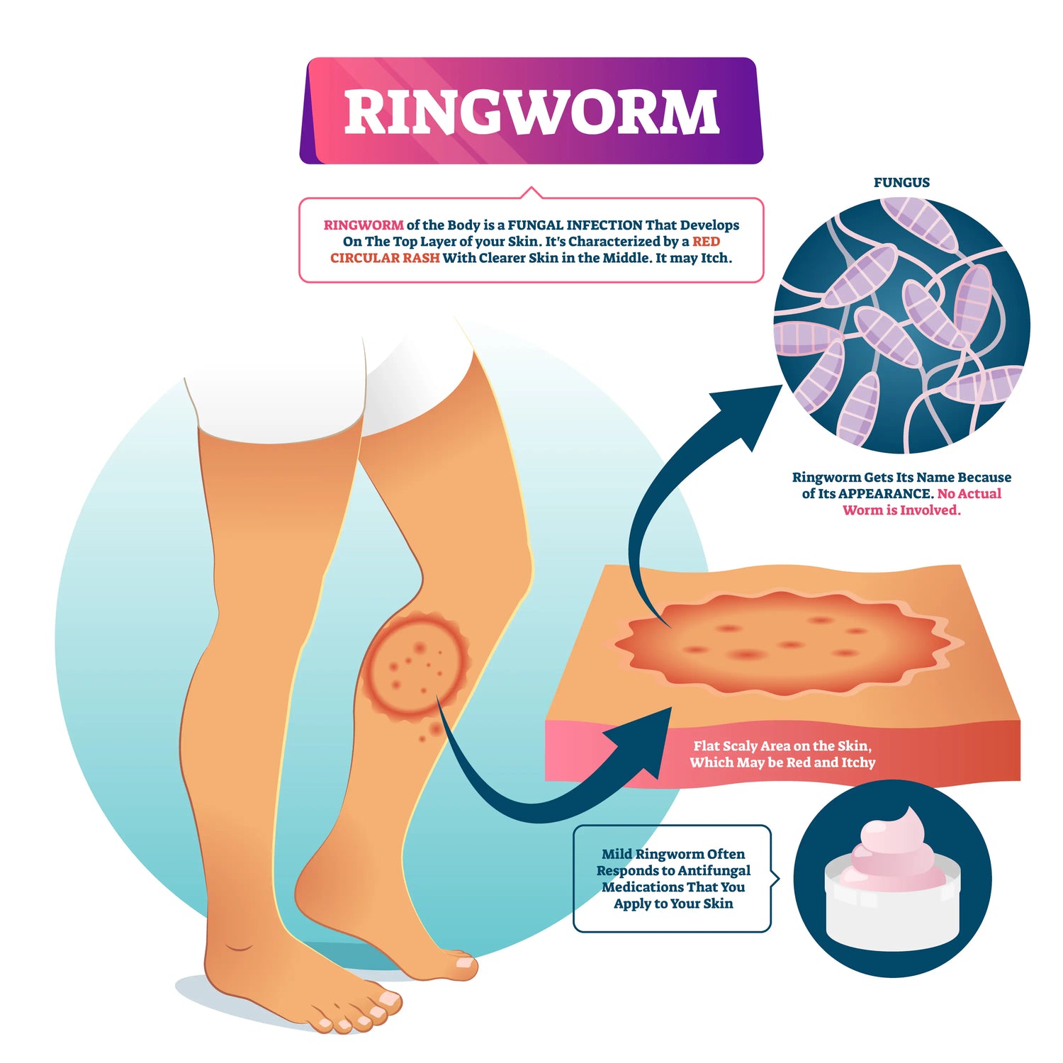 How EMUAIDMAX® Targets the Root of Ringworm