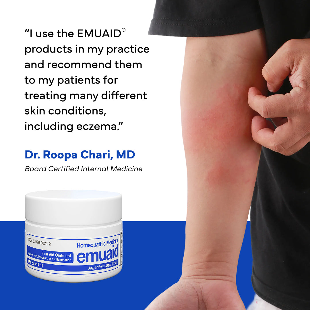 Person with redness on their arm next to an EMUAID product jar, with a quote from Dr. Roopa Chari, MD.