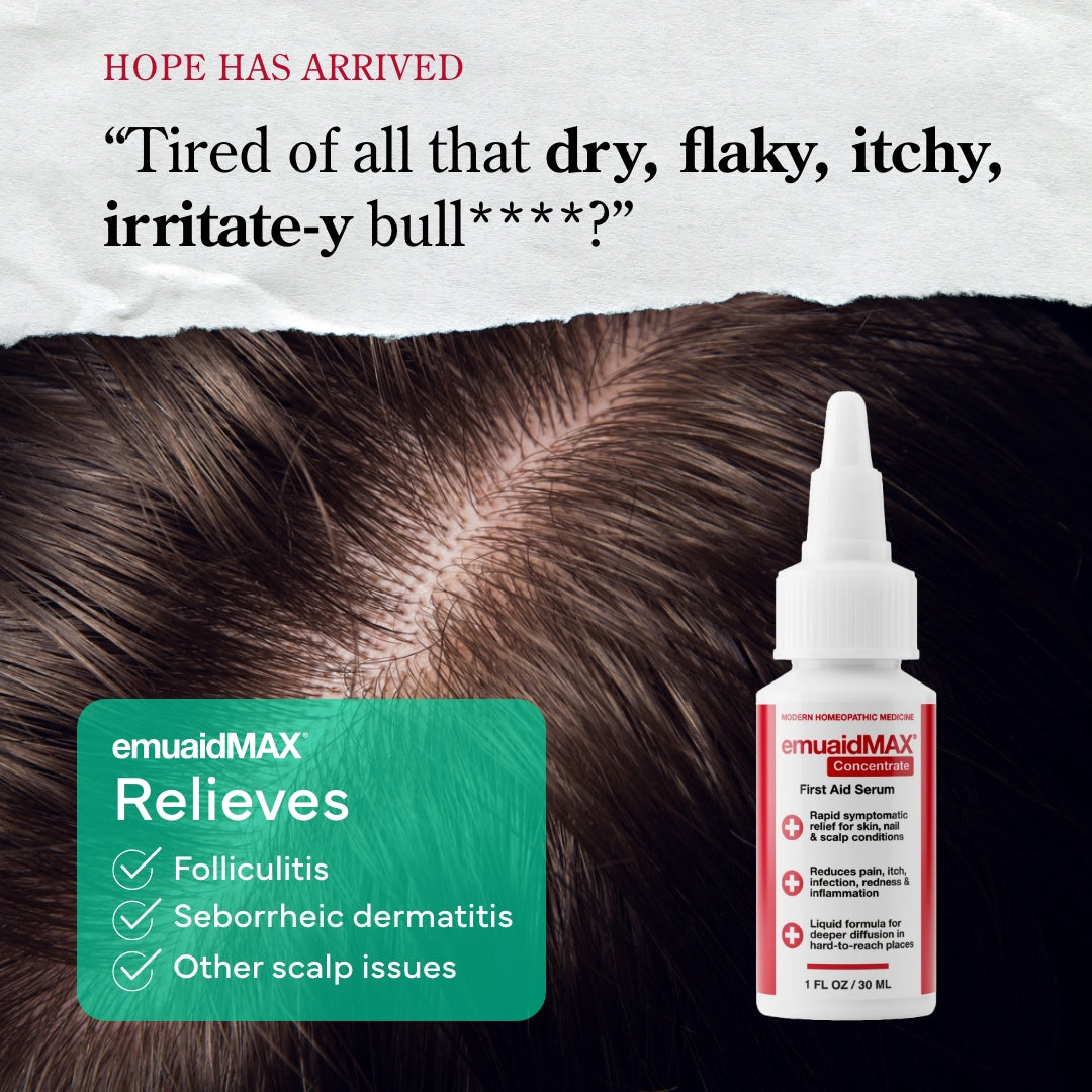 Producto para el cuidado EmuaidMAX , con información sobre problemas de sequedad, descamación y picor en el cuero cabelludo.