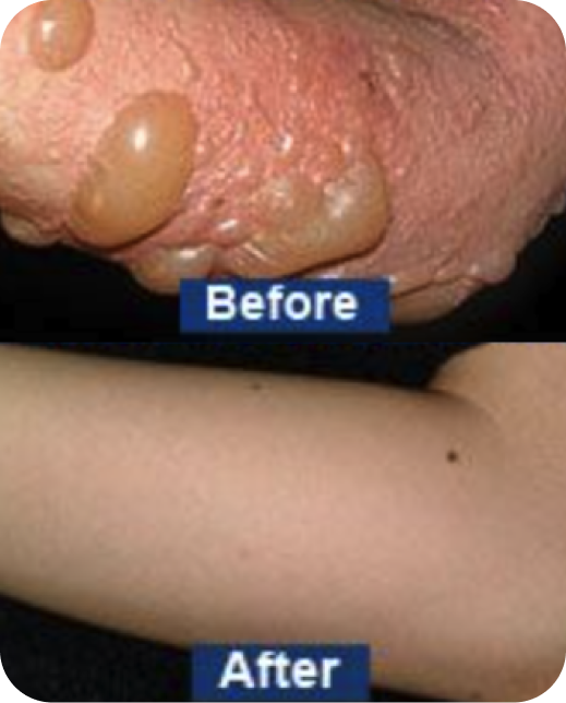 Clinical study results