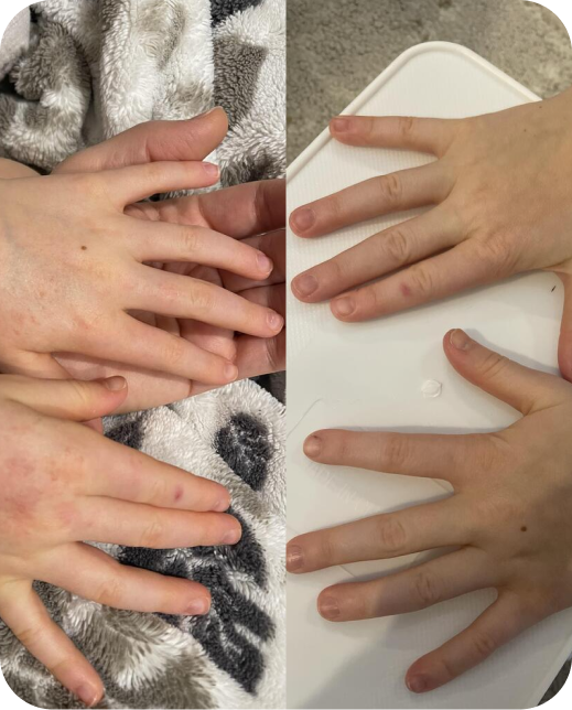 Clinical study results