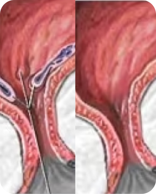 Clinical study results