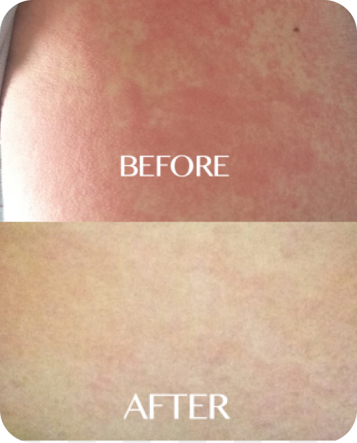 Clinical study results