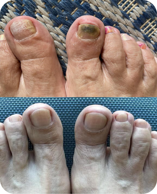 Clinical study results