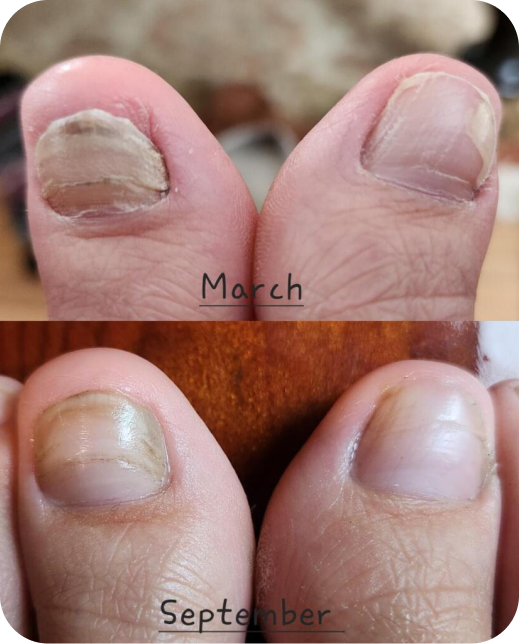 Clinical study results