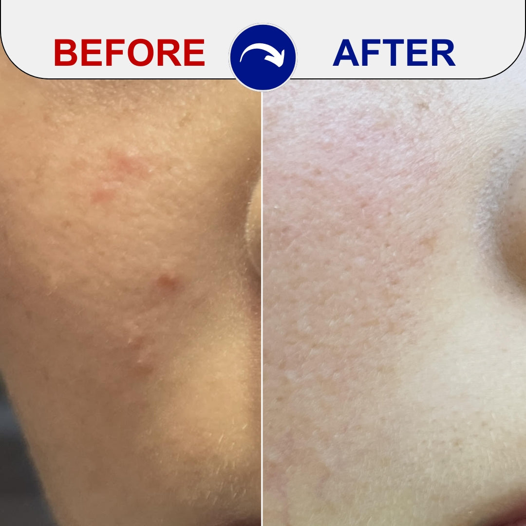 Emuaid Lawsuit: Shocking Skin Cream Claims! Your Biggest Questions Answered. - 55zo4ze