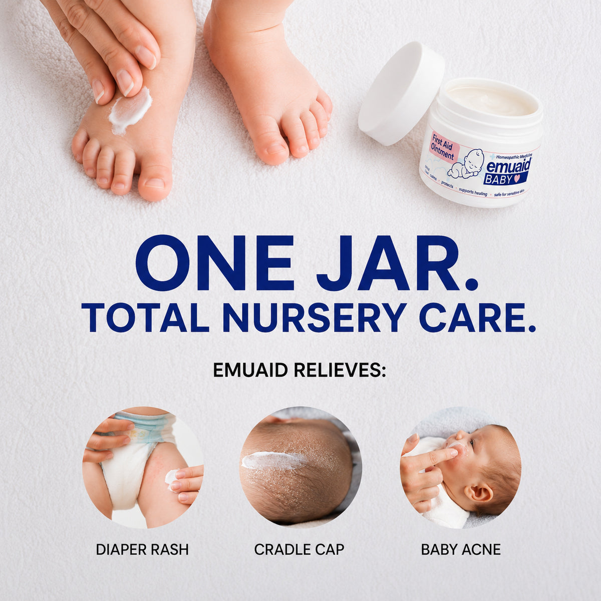 EMUAID Baby - Sollievo per la pelle difficile e sensibile