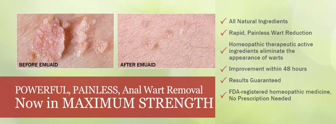 Infographic on warts